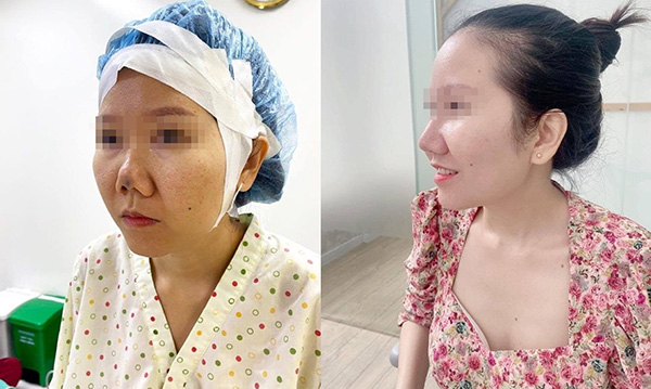 Bác sĩ Hồ Phi Nhạn – Chuyên gia sửa mũi hỏng, khắc phục biến chứng - 3