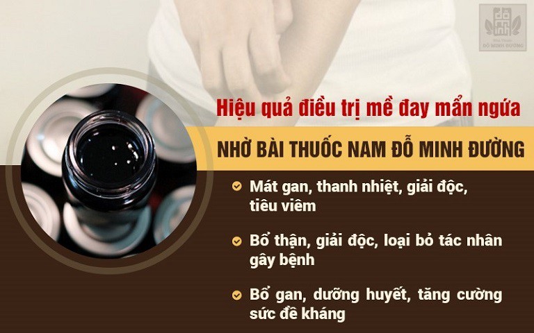 Hiệu quả điều trị bệnh mề đay của bài thuốc Mề đay Đỗ Minh