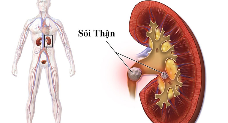 Các vị trí đau bụng và cách đoán bệnh chính xác nhất