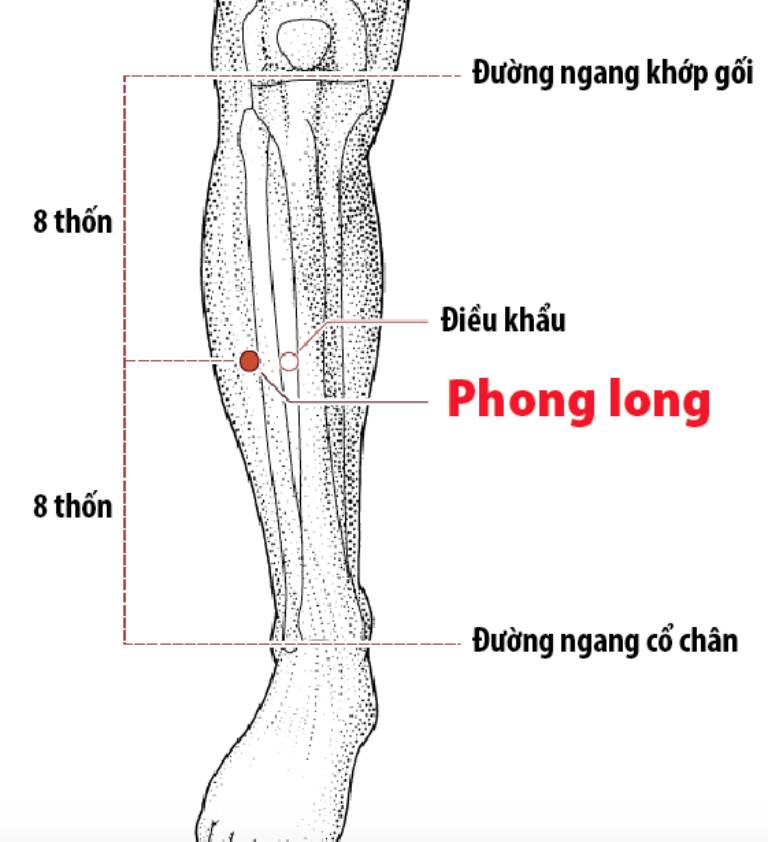 Huyệt Phong long cải thiện các triệu chứng viêm amidan