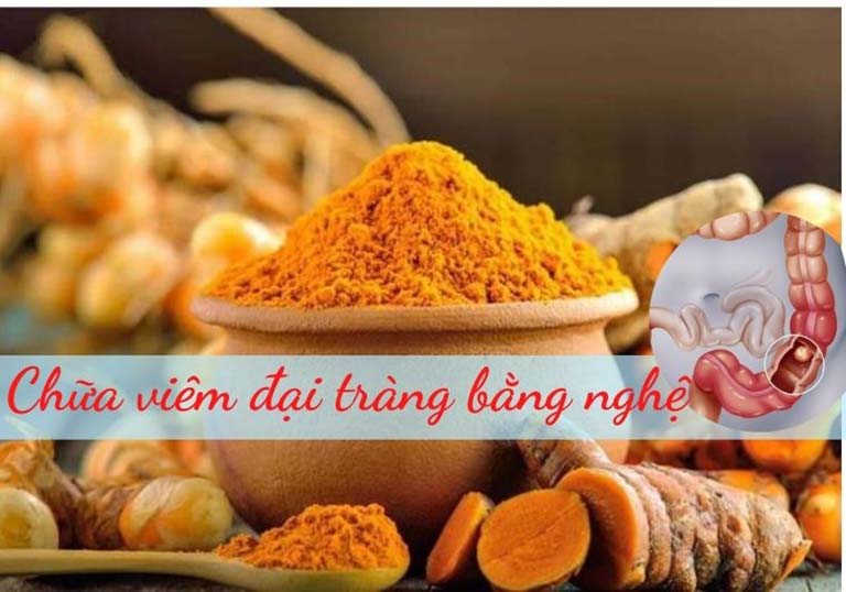 Chữa viêm đại tràng bằng nghệ