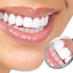 Review 7 địa chỉ bọc răng sứ thẩm mỹ chất lượng và uy tín tại TPHCM