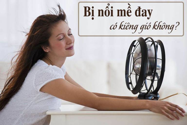 Mề đay có kiêng gió không? Lời khuyên từ bác sĩ