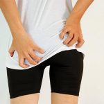 Nguyên nhân và cách xử lý bệnh nổi mẩn ngứa ở mông