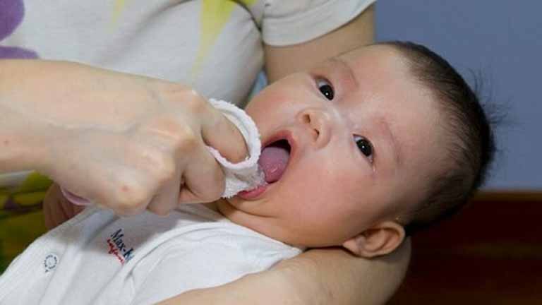 Khi nào trẻ sơ sinh cần rơ lưỡi?