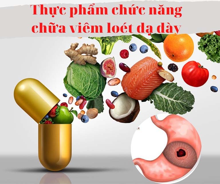 Thực phẩm chức năng chữa viêm loét dạ dày