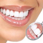 Review 9 địa chỉ nha khoa trám răng thẩm mỹ tốt nhất TPHCM