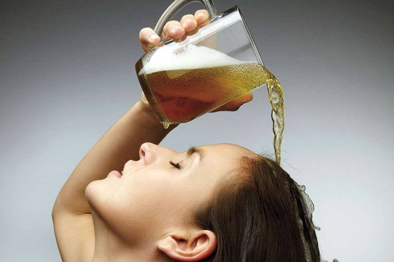 Trị nấm da đầu bằng bia chỉ là mẹo, không thể thay thế thuốc đặc trị