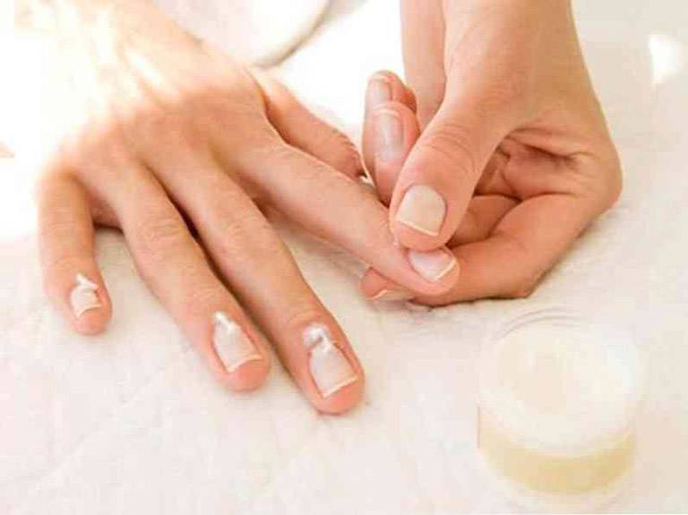 Sử dụng thuốc điều trị giúp cải thiện các triệu chứng của bệnh vảy nến móng tay