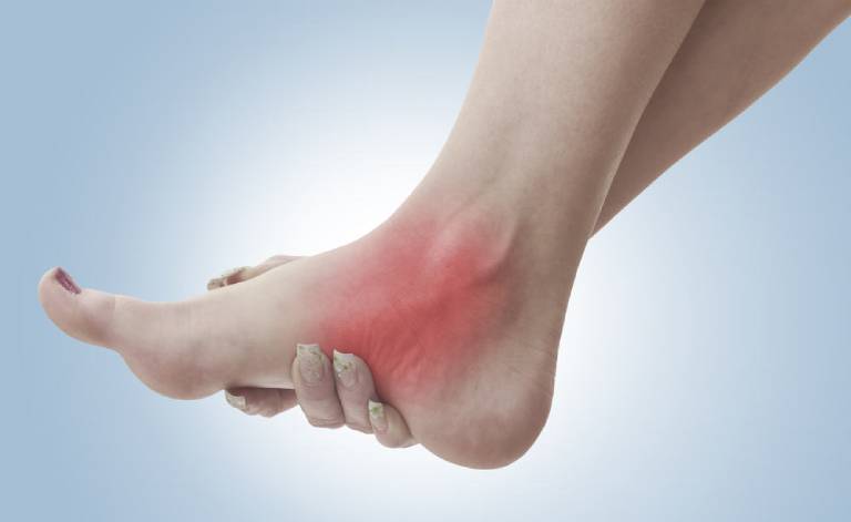 Nguyên nhân và phương pháp điều trị bệnh Viêm khớp cổ chân