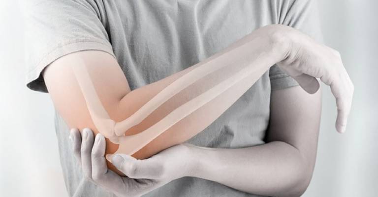 Dấu hiệu nhận biết và phương pháp điều trị Viêm khớp khuỷu tay