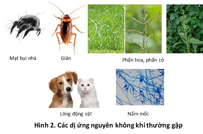 viêm mũi dị ứng ở trẻ em