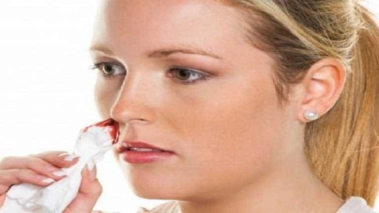 Biện pháp chăm sóc cho người bệnh viêm xoang chảy máu mũi
